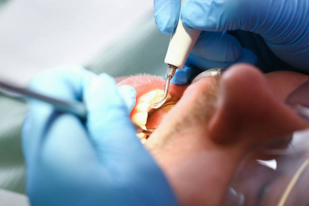Best Emergency Treatment for Toothache in Ivanhoe, TX