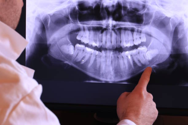 Best Emergency Treatment for Toothache in Ivanhoe, TX